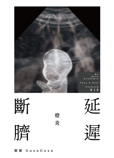 延遲斷臍